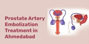 Uterine Fibroid Embolisation in Ahmedabad

